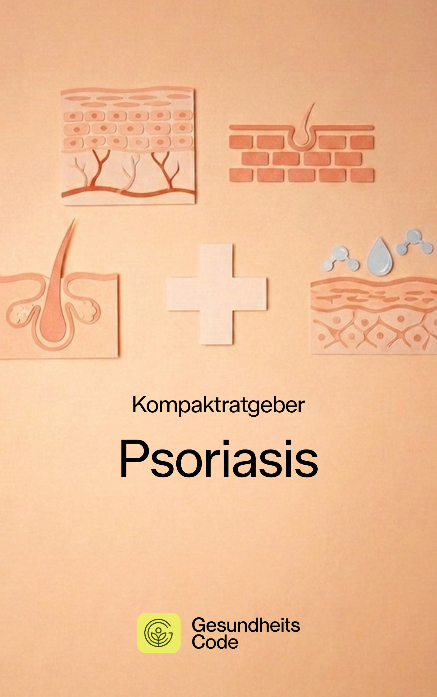 Psoriasis | E-Book